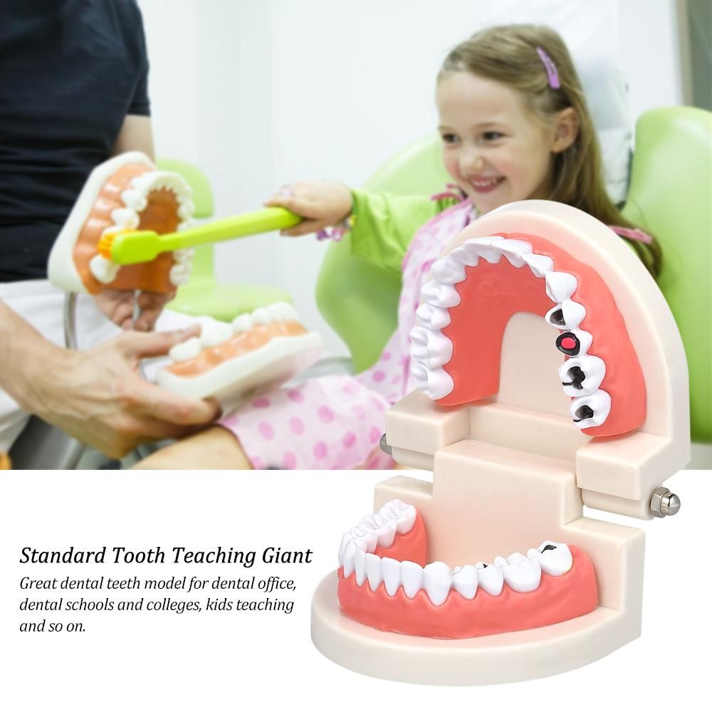 Standard Tooth Teaching Giant Dental Dentist Teeth Model Child Kidtraining Model Disease Teeth Medical Educational Model
