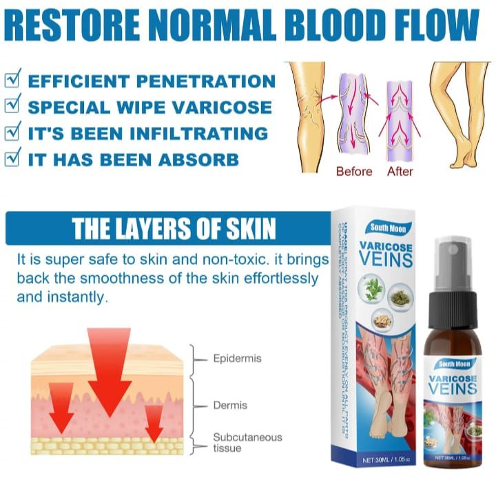 Premium Varicose Vein Removal Cream