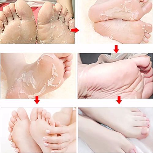 Exfoliating Foot Mask