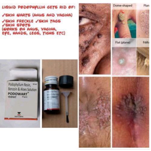 Podophyllin Fluid Skin Warts/Freckle/Spots/Tags Cream