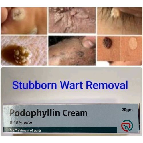 Podophyllin Cream For  Warts Treatment