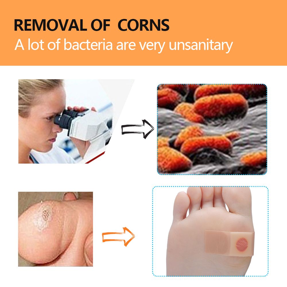 Problem Patch Plantar Remove Calluses Warts Exfoliating Corn Removed Foot Povihome Feet Foot 6Pcs Soft Treatment C1443 Skin