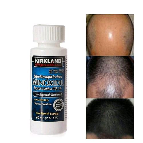Kirkland Signature Minoxidil 5% Extra Strength, Hair, & Beard Growth Treatment