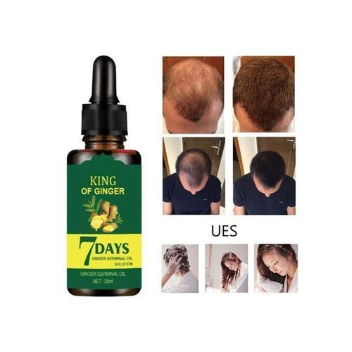 King Of Ginger (7Days Ginger Germination Hair Growth Oil 30ML)