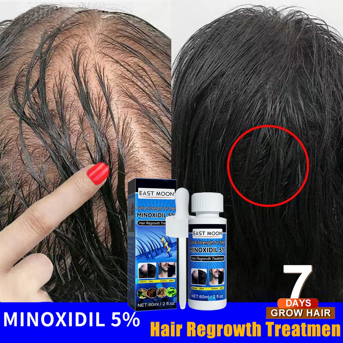 Hair Increase Oil - Hair Treatment - Beard And Hair Growth