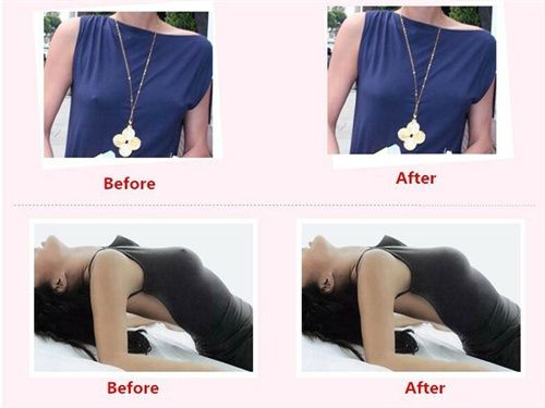 10PCS Bare Lifts Instant Breast Lift Support Invisible Bra Shaper Adhesive Tape