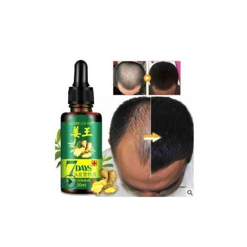Ginger Germinal Oil/Anti Hair Loss&Bald Head Serum