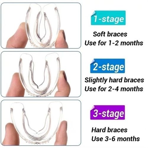 3 Stages Teeth Corrector Bend Brace Aligner-3 Stage
