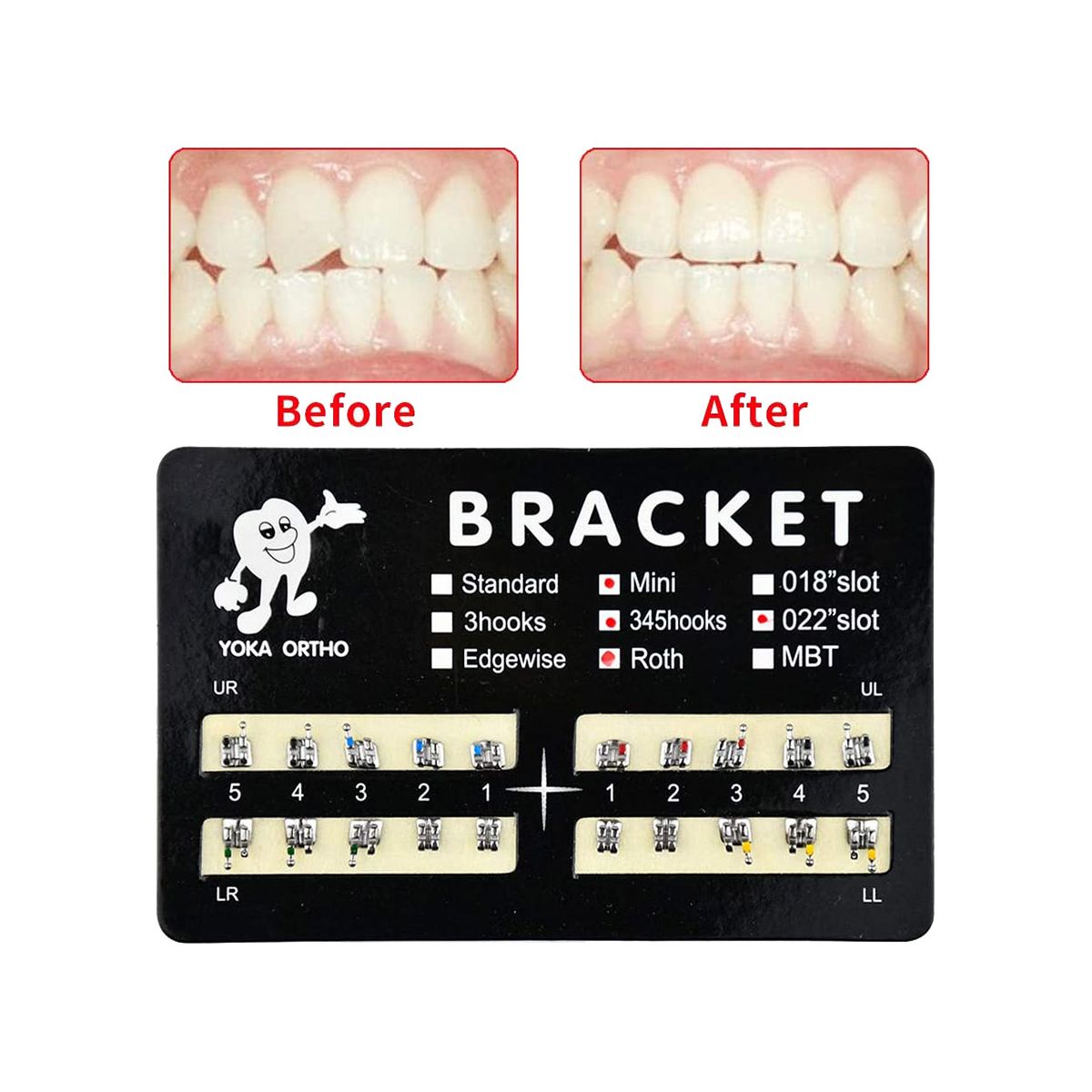 200Pcs Teeth Model Mini Brackets 022 Slot Bondable with Hook on 345