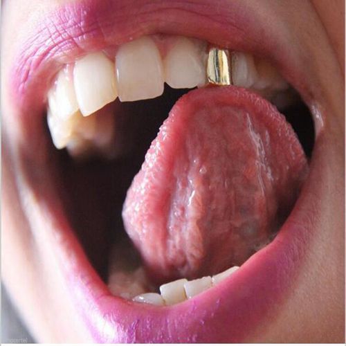 Gold Plated Hip Hop Teeth Top & Bottom Grill Set