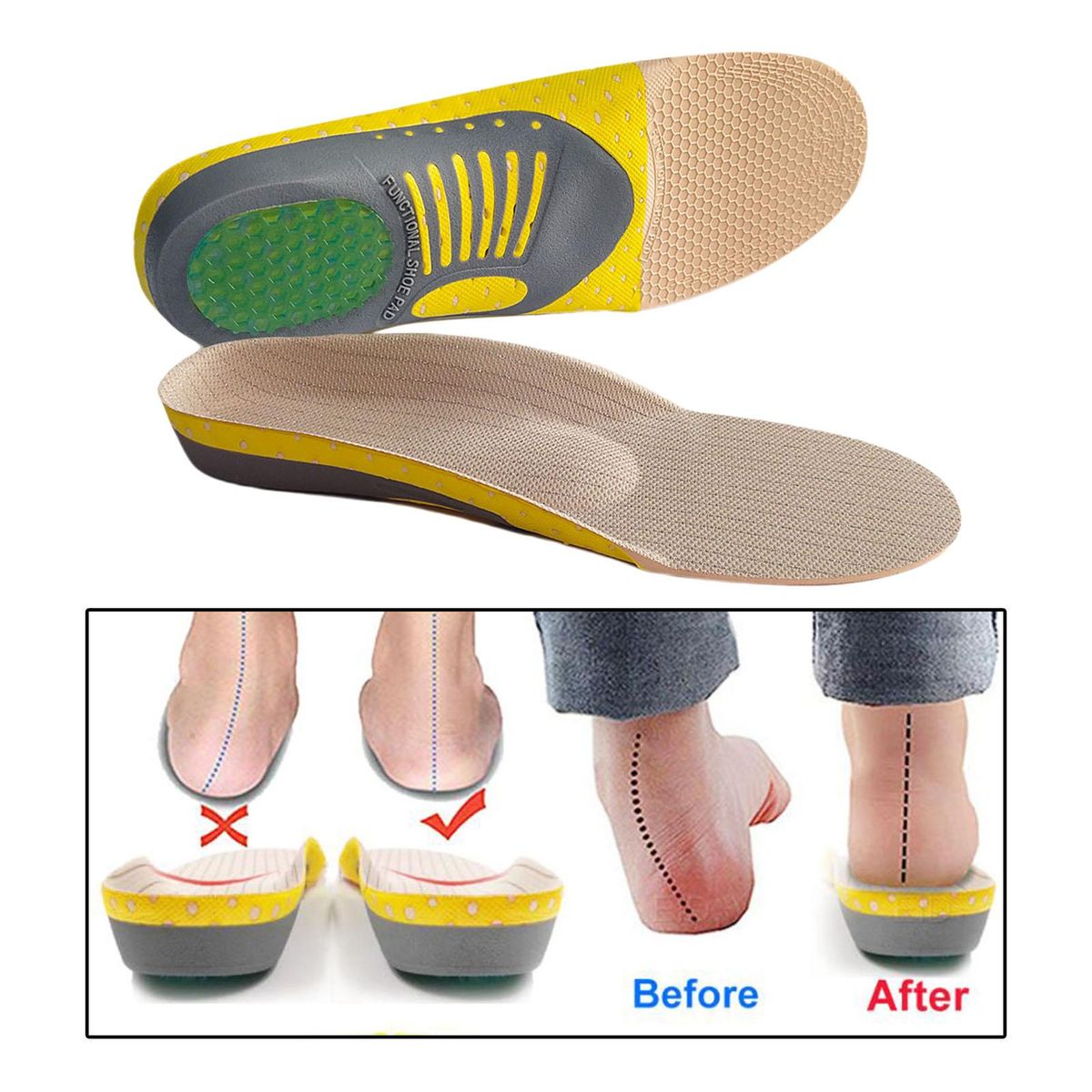 Orthopedic Flat Foot Sole Pad Orthotic Insoles Breathable Fabric Feet