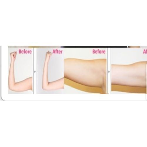 Upper Arm  Shape
