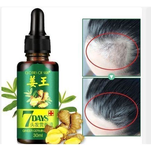 Ginger Germinal Oil/Anti Hair Loss&Bald Head Serum
