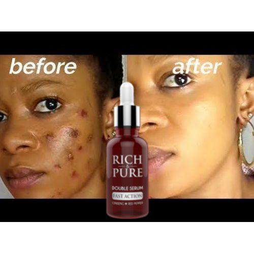 Rich And Pure Double Serum