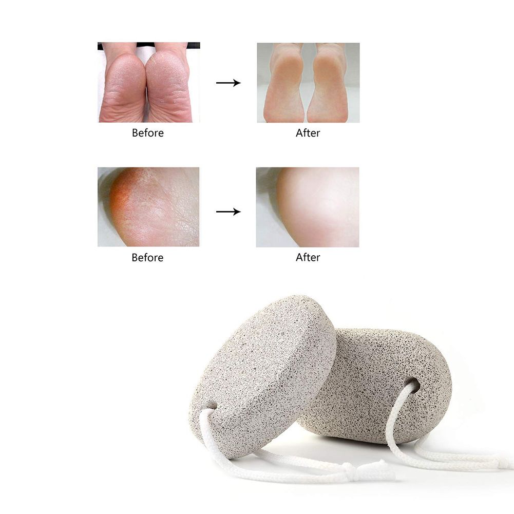 Oval Pumice Stone Foot Grinder Death Hard Skin Callus-