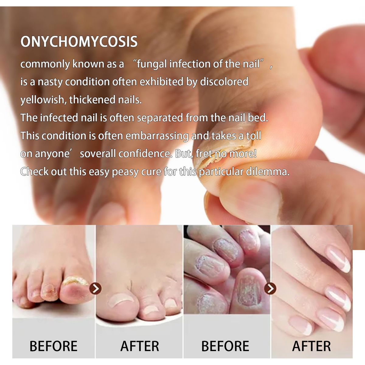 Ginger Foot Soak Ginger Foot Bath Bag Foot Reflexology Spa