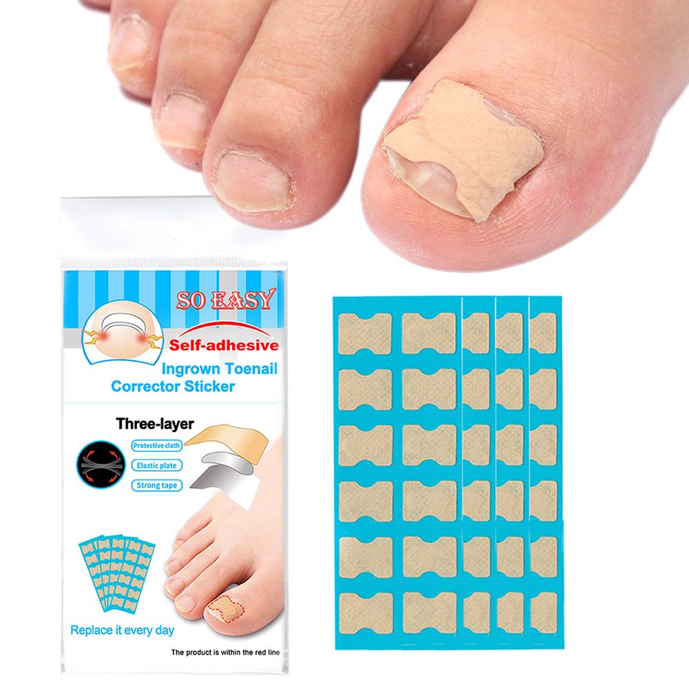 Ingrown Toenail Corrector Stickers Foot Care Stickers Non