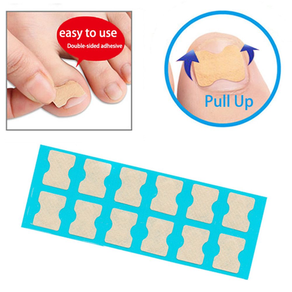 Ingrown Toenail Corrector Stickers Foot Care Stickers Non