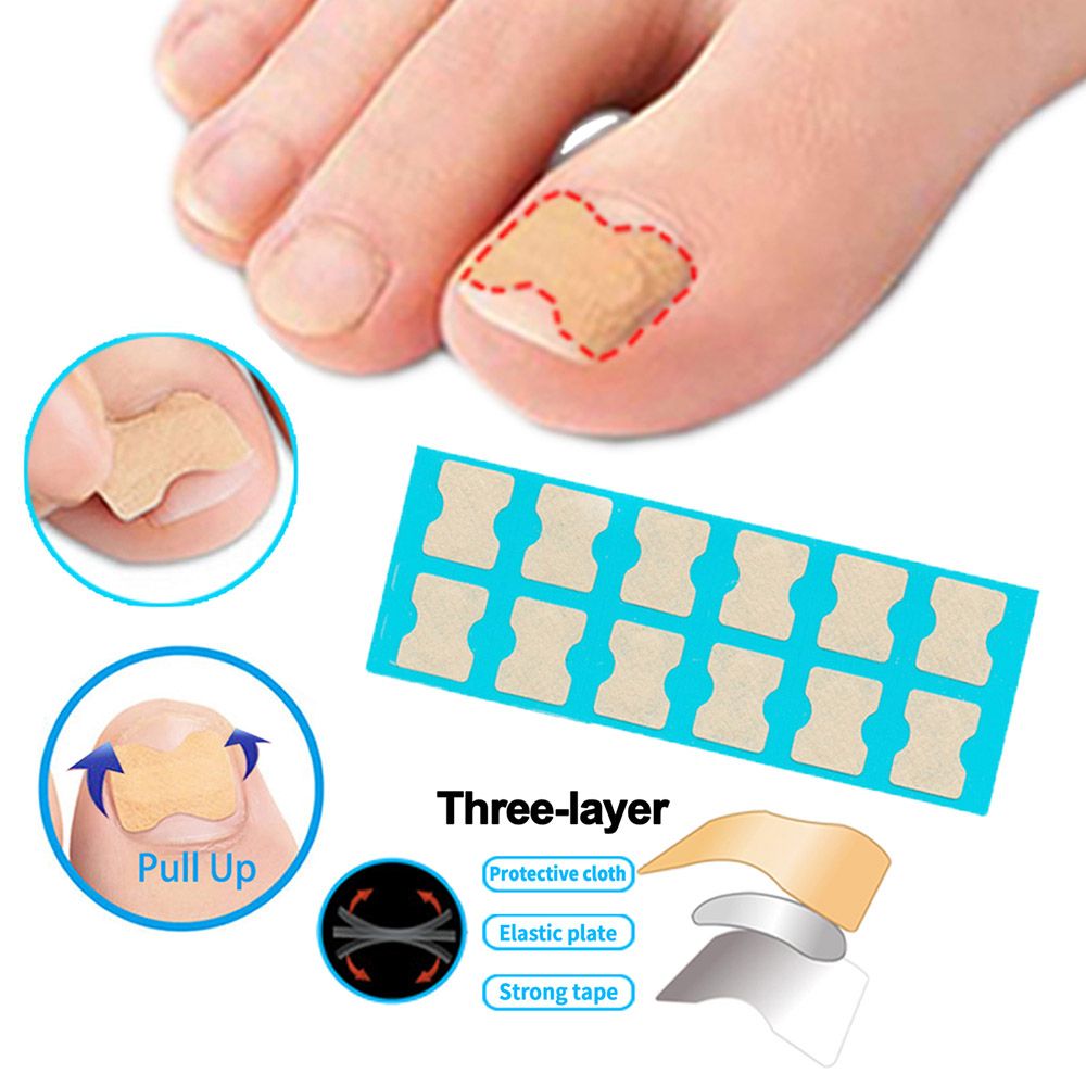 Ingrown Toenail Corrector Stickers Foot Care Stickers Non