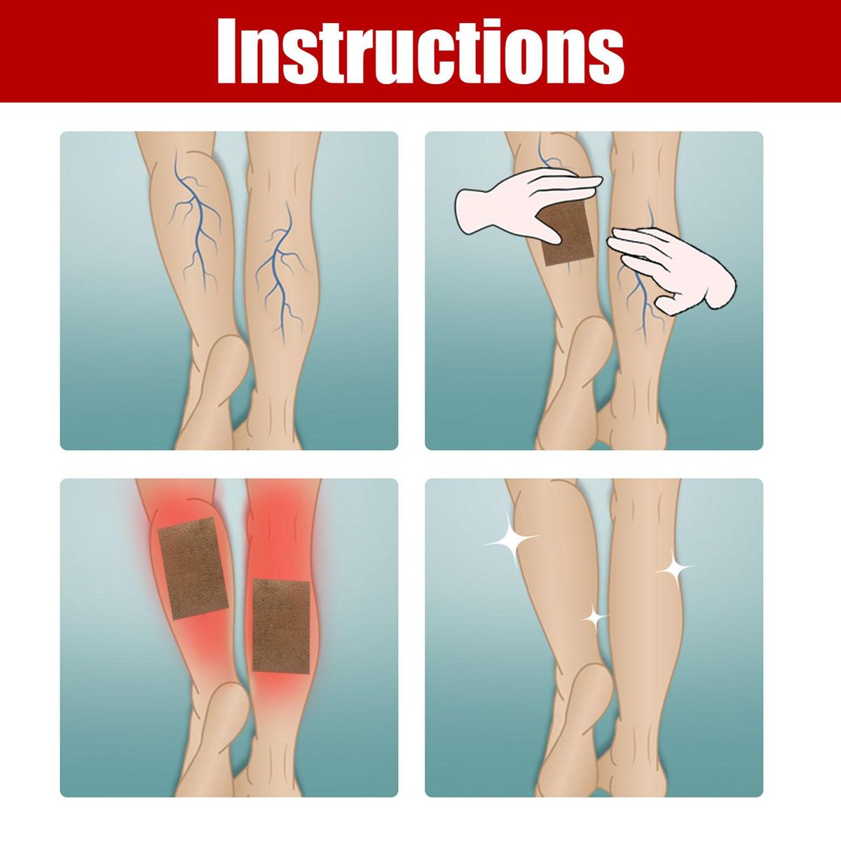JAYSUING 12Pcs Varicose Veins Patches Skin-friendly Non-toxic Improve Varicosity Dredge Vein Relieve Soothe Swelling Pain