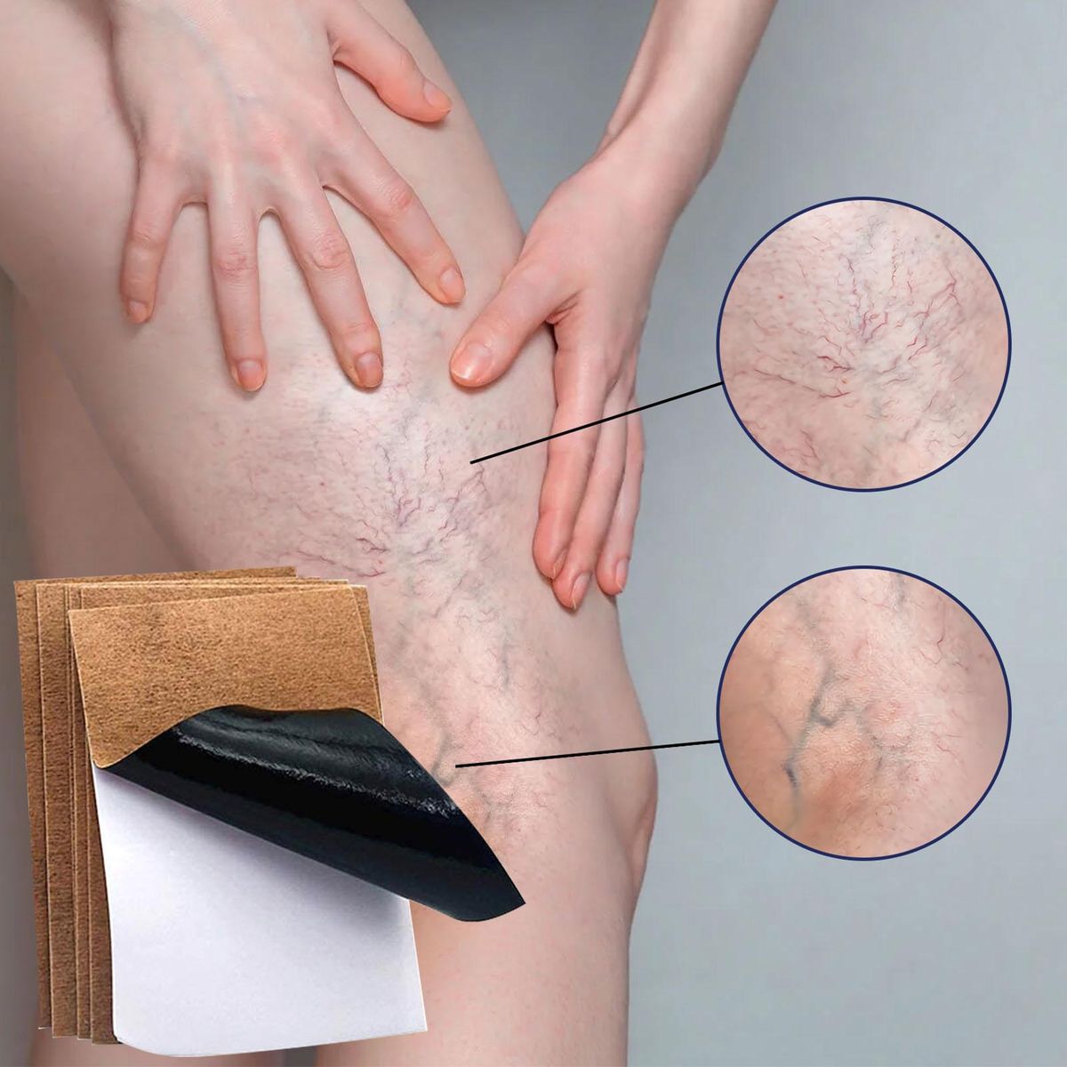 JAYSUING 12Pcs Varicose Veins Patches Skin-friendly Non-toxic Improve Varicosity Dredge Vein Relieve Soothe Swelling Pain