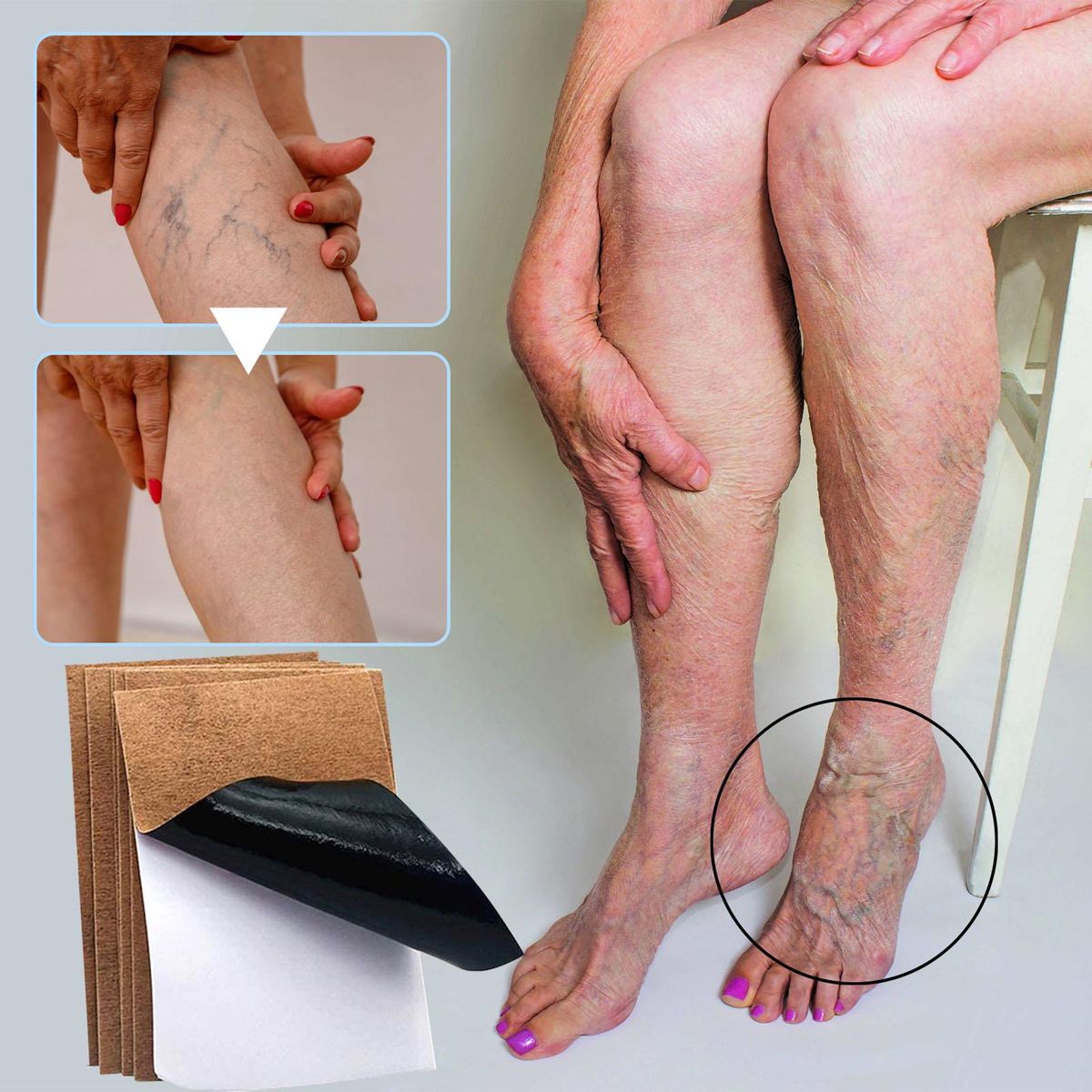 JAYSUING 12Pcs Varicose Veins Patches Skin-friendly Non-toxic Improve Varicosity Dredge Vein Relieve Soothe Swelling Pain