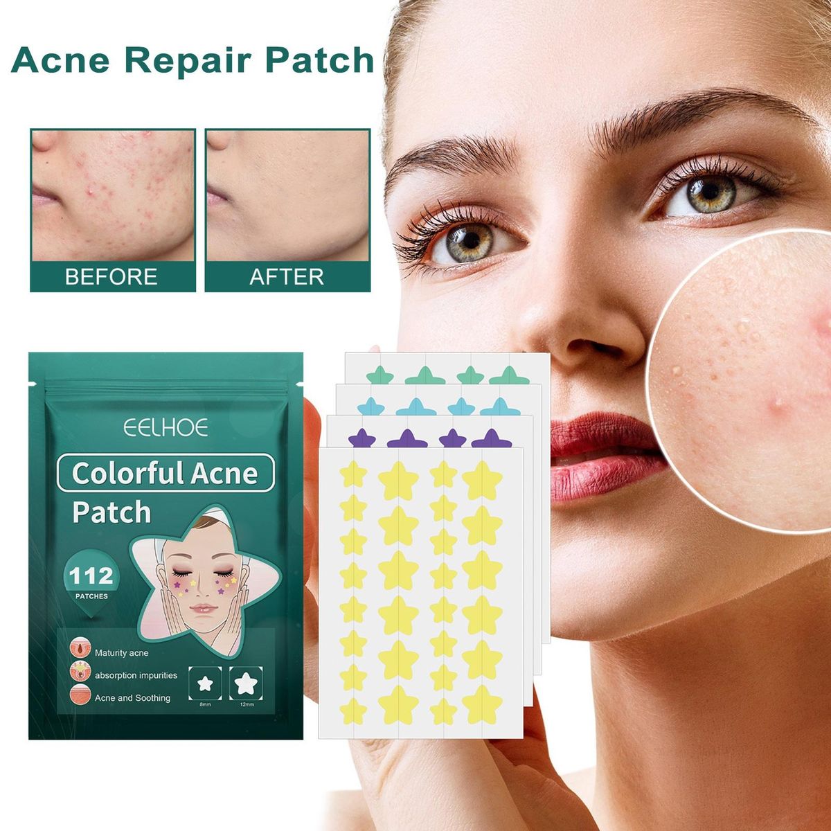 Acne Patches Star Relief Acne Stickers 112 Pcs Fast Repair for Marks