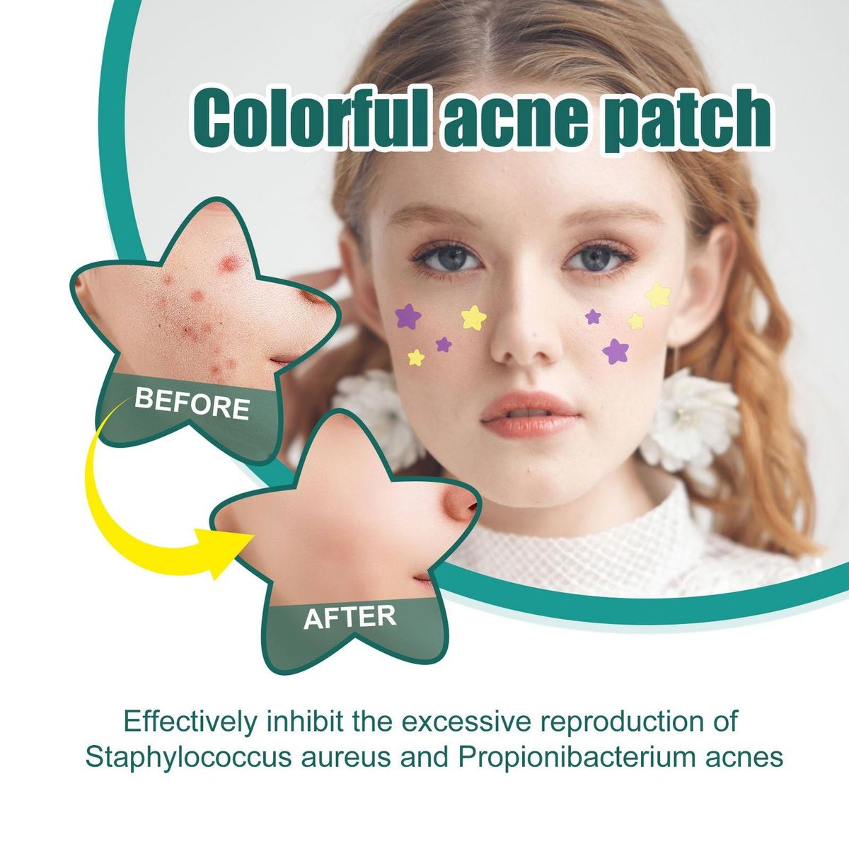Acne Patches Star Relief Acne Stickers 112 Pcs Fast Repair for Marks