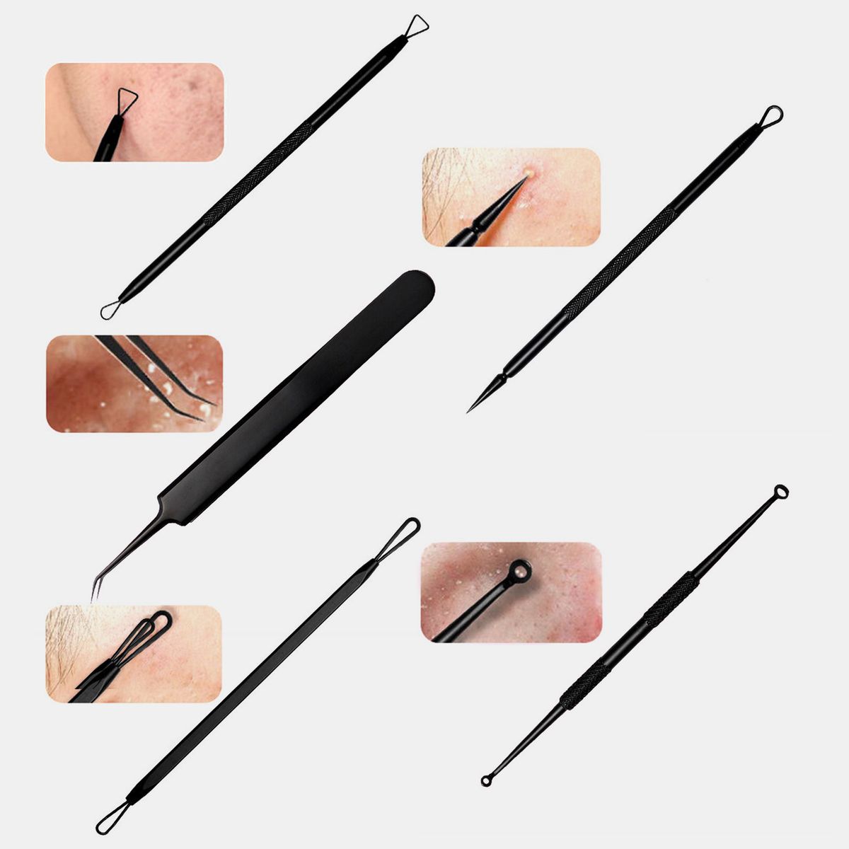 11Pcs Stainless Steel Acne Needle Pimple Tweezers Extractor