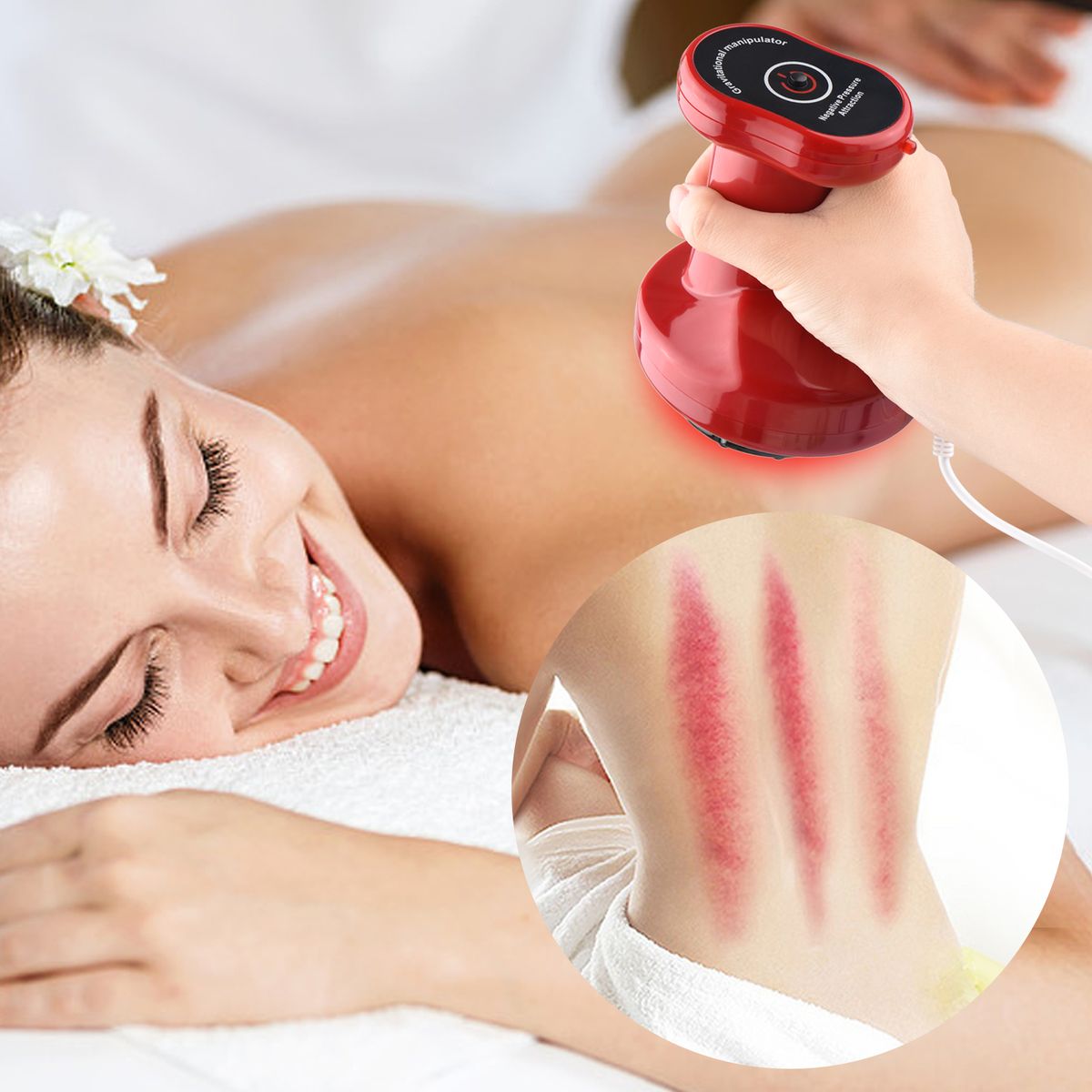 Electric Heat Cupping Device Vacuum Scraping Negative