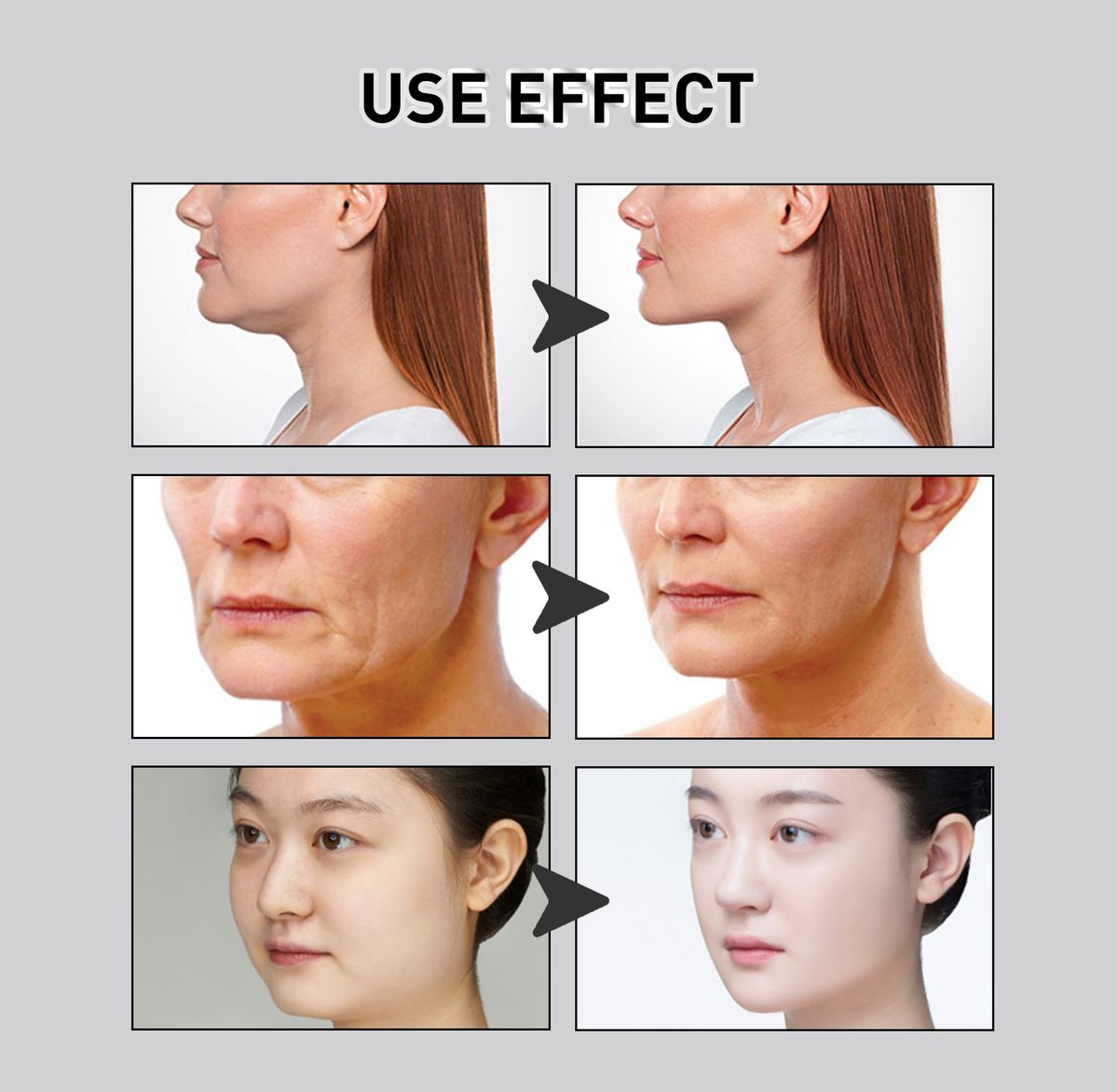 40Pcs V-shaped Invisible Tape Face Lift Tightening Sticker