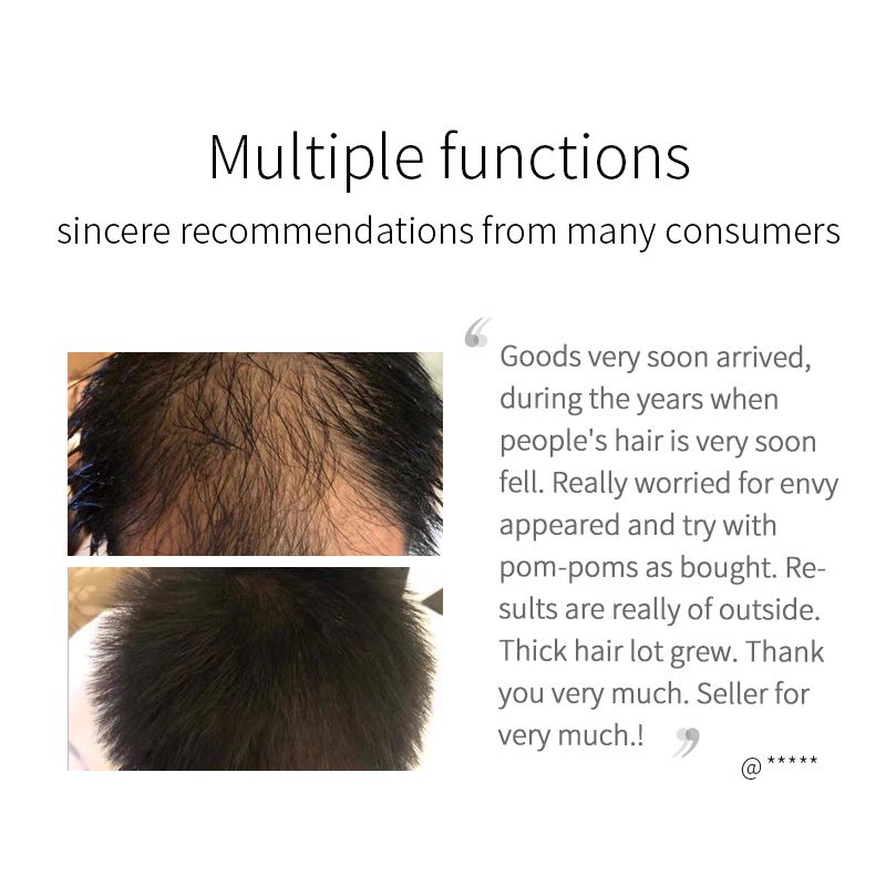 Natural Hair Growth Spray (Fast Action).