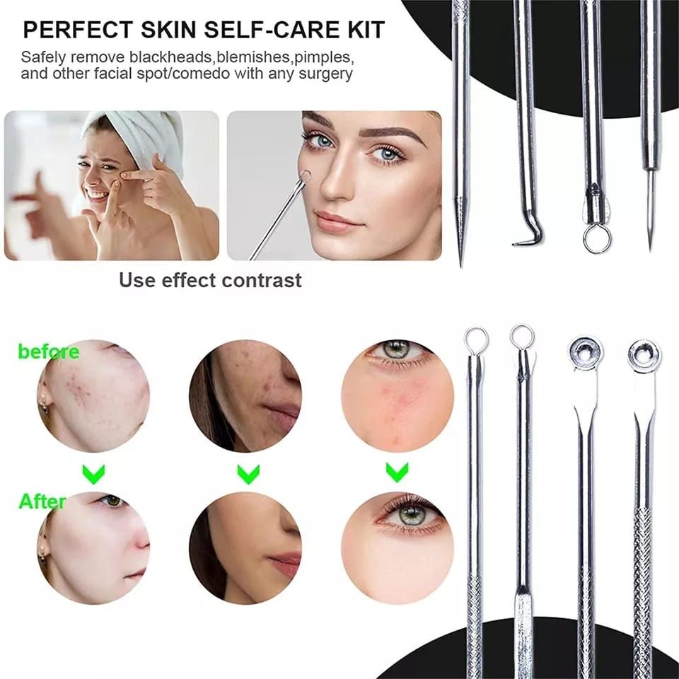 Cool 4pcs Stainless Steel Facial Acne Blackhead Remover Needles Kit Extractor Tool Set