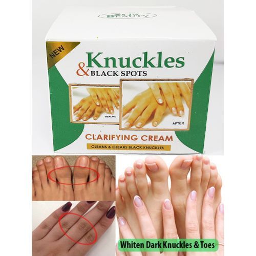 Fast Effective Dark Knuckles/Dark Spots Repair Hand Cream