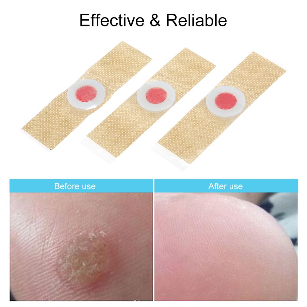 24PCS Corn Remover Wart Remover Foot Corn Remover Pads Corn