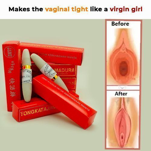 Vagina Tightening/Discharge Treatment