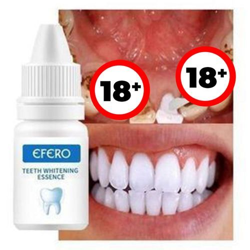 Teeth Whitening
