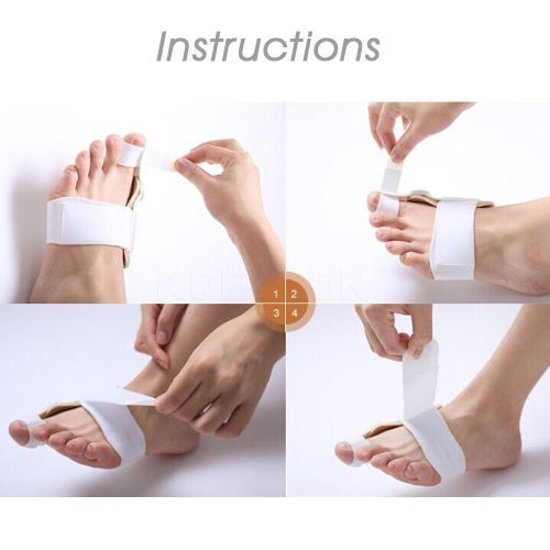 2pcs Bunion Orthopaedic Brace For Big Toe Correction