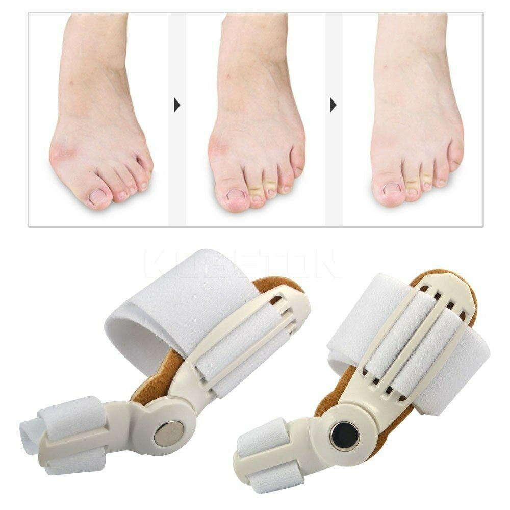 2pcs Bunion Orthopaedic Brace For Big Toe Correction
