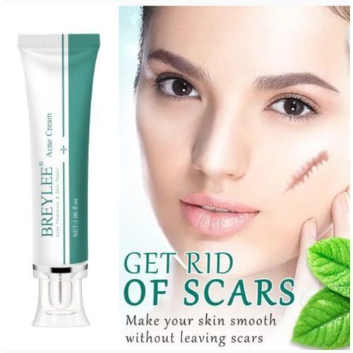 Scar Keloids Repair Cream. (Acne Scar Stretch Marks Remover Keloids Cream Skin Repair Face Cream Acne Spots Acne Treatment Blackhead Whitening Cream Skin Care)