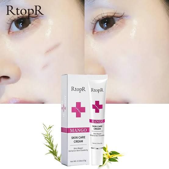 Scar Keloids Repair Cream. (Acne Scar Stretch Marks Remover Keloids Cream Skin Repair Face Cream Acne Spots Acne Treatment Blackhead Whitening Cream Skin Care)