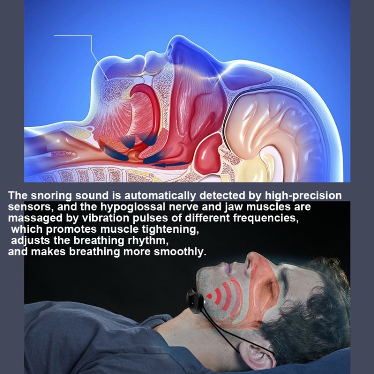 USB Rechargeable Smart Anti-snoring Device