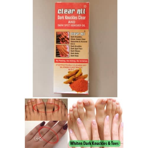Tumeric Clear All Dark Knuckles And Dark Spot Remover Oil - 100ml- 100% Effective - 1piece