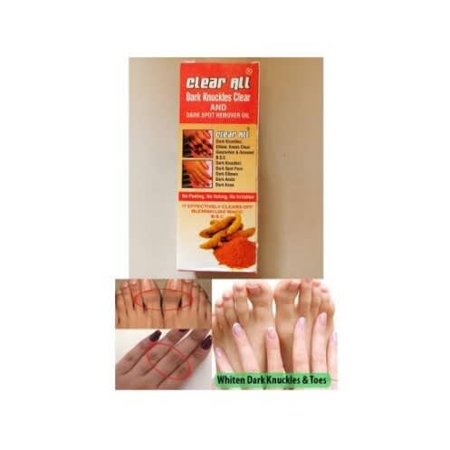 Tumeric Clear All Dark Knuckles And Dark Spot Remover Oil - 100ml- 100% Effective - 1piece