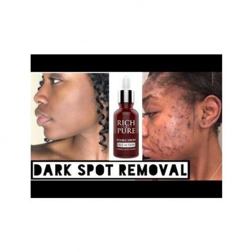 Rich & Pure Double Serum For Acne, Dark Spots & Sunburn Removal 30ml