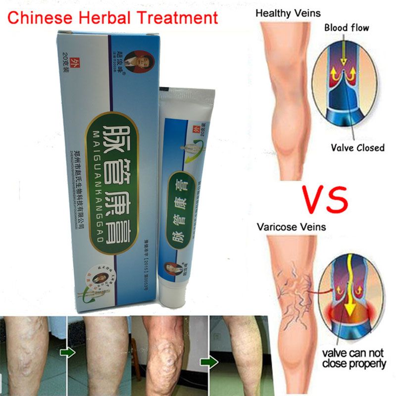 Patches Patch Treatment Herbal Varicose Veins For Treatmen Spider 5Pcs Varicose Natural Solution Cure Vasculitis Veins Plaster A