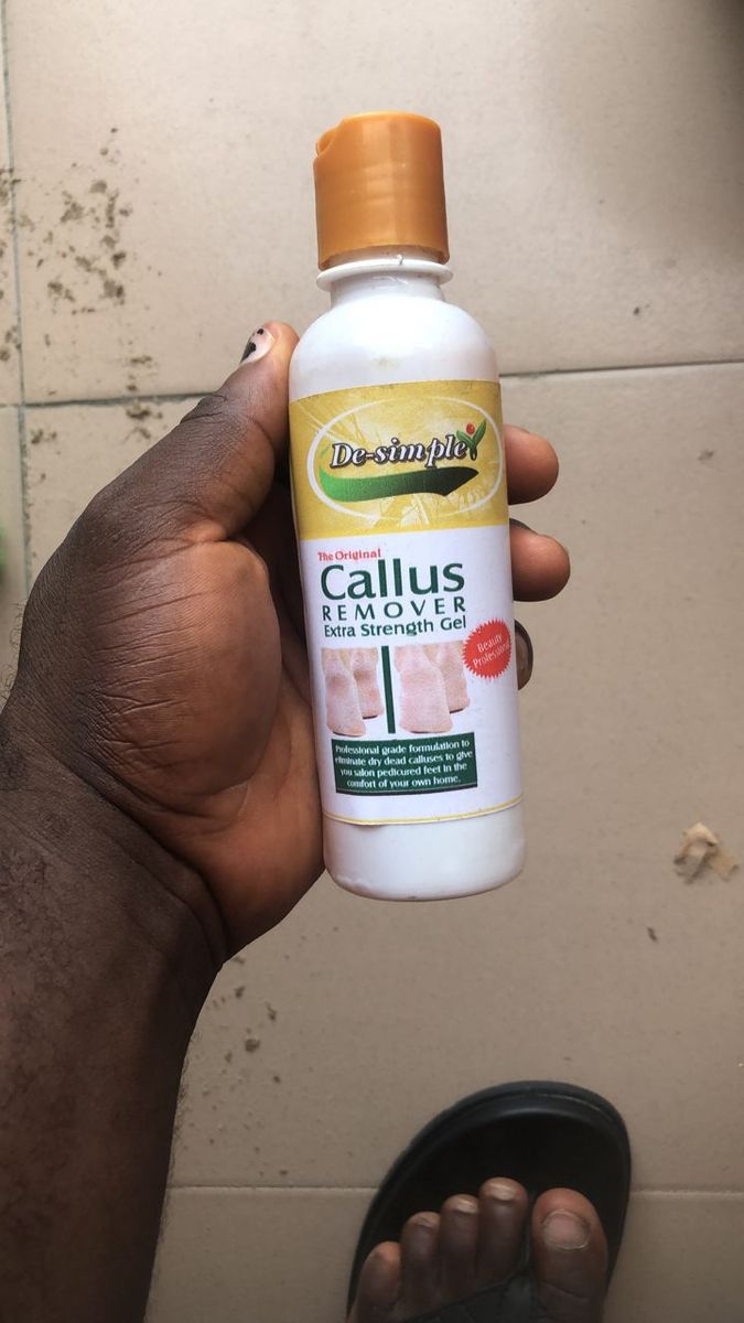 Callus Remover, EXTREME CALLUS REMOVER REMOVES CALLUSES IN SECOND 8oz