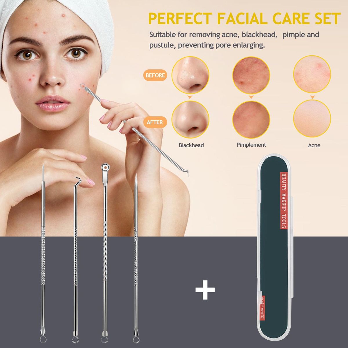 4PCS Stainless steel Acne Removal Kit Blackhead Remover Facial Pimple Comedone Needle