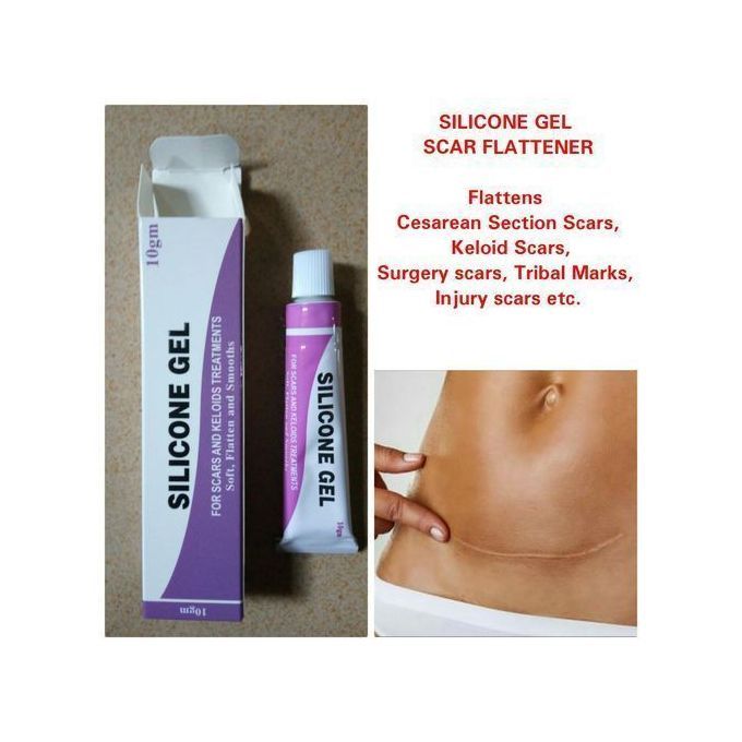 Wonderful Keloid Scar/Tribal Mark Silicone Gel Flattener