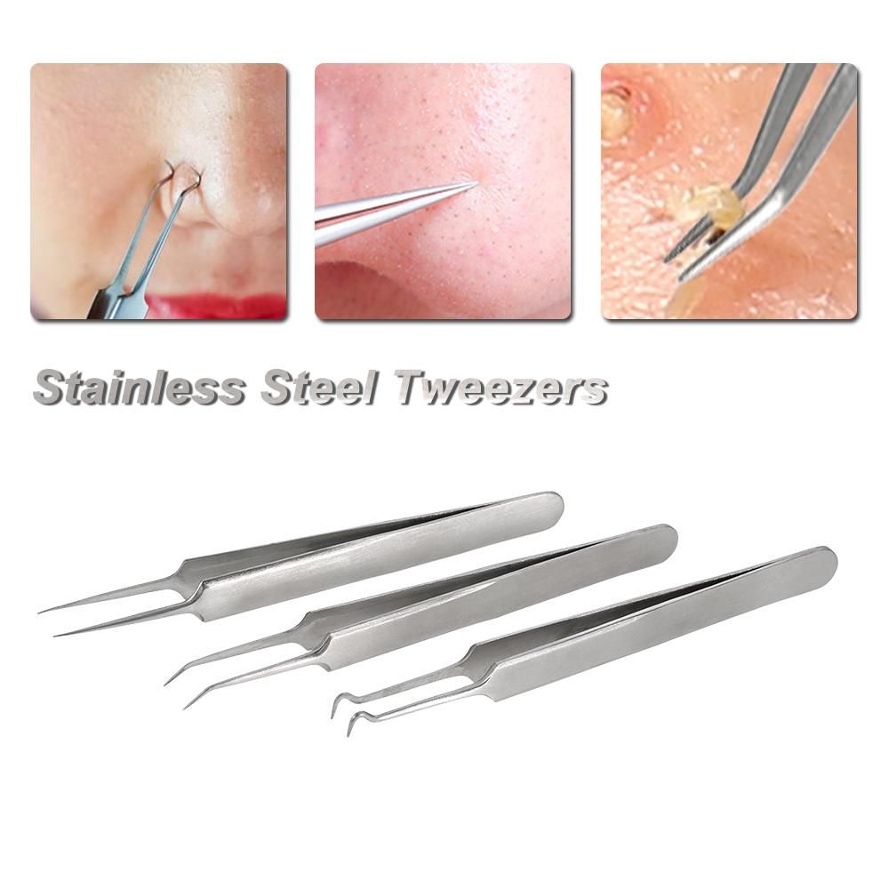 3pcs Acne Clip Facial Pimple Comedone Nippers Curved Straight Blackhead Tweezer Set Stainless Steel Blemish Tools